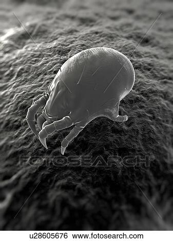 Stock Photograph - Dust mite. Computer artwork of a house dust mite (Dermatophagoides pteronyssinus).. Fotosearch