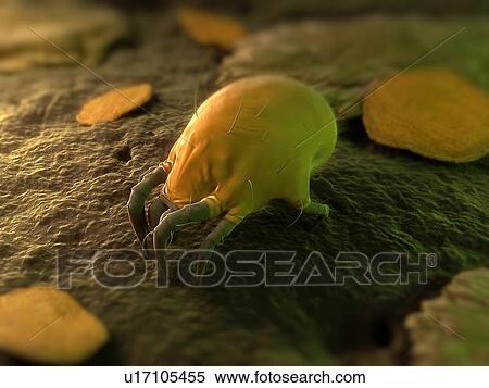 Dust mite. Computer artwork of a house dust mite (Dermatophagoides pteronyssinus). View Large Photo Image Stock Photography - Dust mite. Computer artwork of a house dust mite (Dermatophagoides pteronyssinus).. Fotosearch