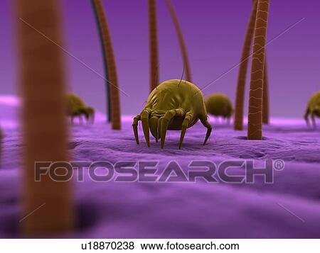 Dust mites. Computer artwork of house dust mites (Dermatophagoides pteronyssinus) on human skin. View Large Photo Image Stock Photo - Dust mites. Computer artwork of house dust mites (Dermatophagoides pteronyssinus) on human skin.. Fotosearch