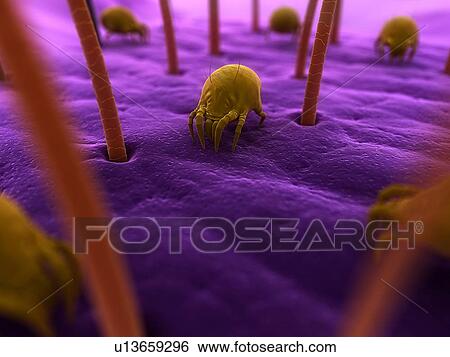 Dust mites. Computer artwork of house dust mites (Dermatophagoides pteronyssinus) on human skin. View Large Photo Image Stock Photograph - Dust mites. Computer artwork of house dust mites (Dermatophagoides pteronyssinus) on human skin.. Fotosearch