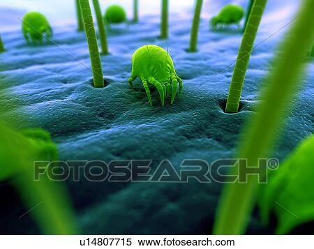 Dust mites. Computer artwork of house dust mites (Dermatophagoides pteronyssinus) on human skin. View Large Photo Image Stock Photography - Dust mites. Computer artwork of house dust mites (Dermatophagoides pteronyssinus) on human skin.. Fotosearch