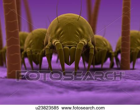 Dust mites. Computer artwork of house dust mites (Dermatophagoides pteronyssinus) on human skin. View Large Photo Image Stock Photography - Dust mites. Computer artwork of house dust mites (Dermatophagoides pteronyssinus) on human skin.. Fotosearch