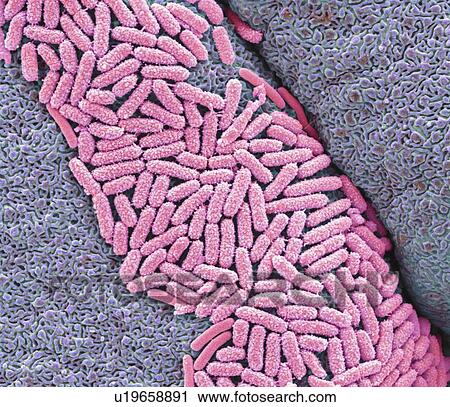Stock Image - E. coli bacteria. Coloured scanning electron micrograph (SEM) of Escherichia coli bacteria (pink) on a gecko's tongue. Magnification: x8000 when printed at 10 centimetres wide.. Fotosearch