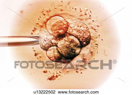 Stock Image - Embryo selection for in vitro fertilisation (IVF), light micrograph.. Fotosearch