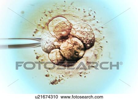 Stock Image - Embryo selection for in vitro fertilisation (IVF), light micrograph.. Fotosearch