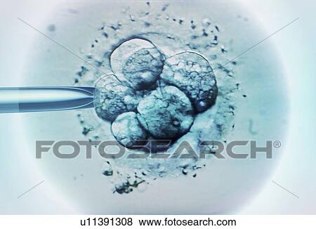 Stock Photo - Embryo selection for IVF, light micrograph.. Fotosearch