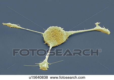 Stock Photo - Fibroblast cell, coloured scanning electron micrograph (SEM). Fibroblasts are cells that give rise to connective tissue such as collagen, the main structural protein in the body. Magnification: x2000 when printed at 10 centimetres wide.. Fotosearch