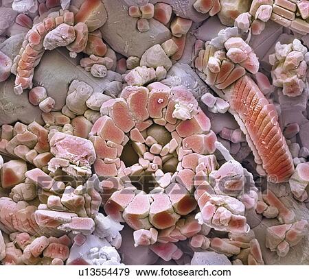 Fossil debris in chalk. Coloured scanning electron micrograph (SEM) of a fossilised fragment of a coccolithotrope skeleton. View Large Photo Image Stock Photo - Fossil debris in chalk. Coloured scanning electron micrograph (SEM) of a fossilised fragment of a coccolithotrope skeleton.. Fotosearch