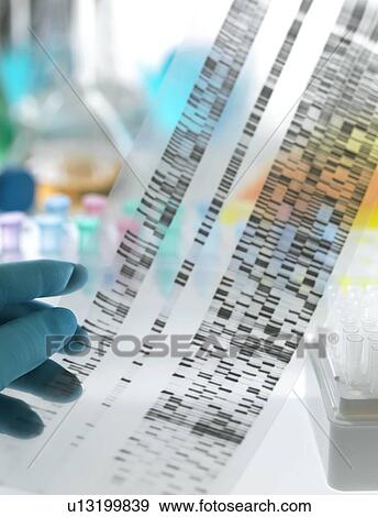 Stock Photo - Genetic research. DNA (deoxyribonucleic acid) autoradiogram.. Fotosearch