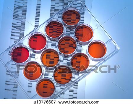 Stock Photo - Genetic research. Medium tray sitting on a DNA (deoxyribonucleic acid) autoradiogram.. Fotosearch