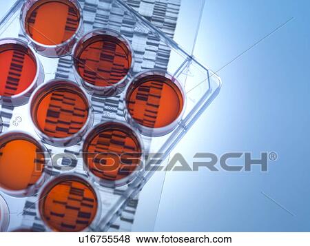 Stock Photo - Genetic research. Medium tray sitting on a DNA (deoxyribonucleic acid) autoradiogram.. Fotosearch