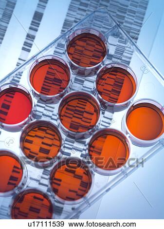 Stock Photo - Genetic research. Medium tray sitting on a DNA (deoxyribonucleic acid) autoradiogram.. Fotosearch
