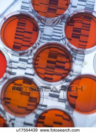 Stock Photo - Genetic research. Medium tray sitting on a DNA (deoxyribonucleic acid) autoradiogram.. Fotosearch