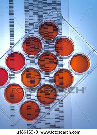 Stock Photo - Genetic research. Medium tray sitting on a DNA (deoxyribonucleic acid) autoradiogram.. Fotosearch