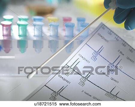 Stock Photography - Genetic testing. DNA (deoxyribonucleic acid) swab and genetic test results.. Fotosearch