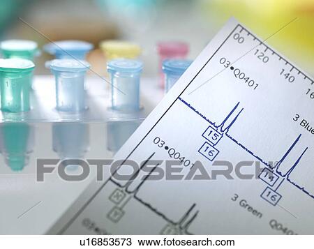Stock Image - Genetic testing.. Fotosearch