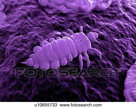 Head louse (Pediculus humanus capitis), computer artwork. View Large Photo Image Stock Image - Head louse (Pediculus humanus capitis), computer artwork.. Fotosearch