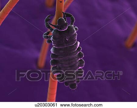 Stock Image - Head louse (Pediculus humanus capitis), computer artwork.. Fotosearch