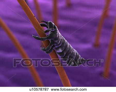 Head louse (Pediculus humanus capitis), computer artwork. View Large Photo Image Stock Photo - Head louse (Pediculus humanus capitis), computer artwork.. Fotosearch