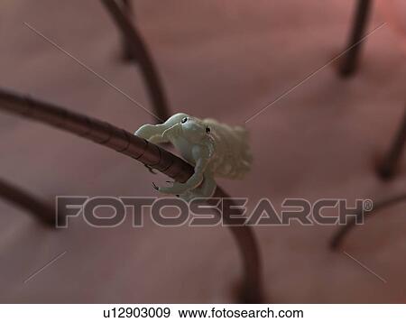 Stock Photo - Head louse (Pediculus humanus capitis), computer artwork.. Fotosearch