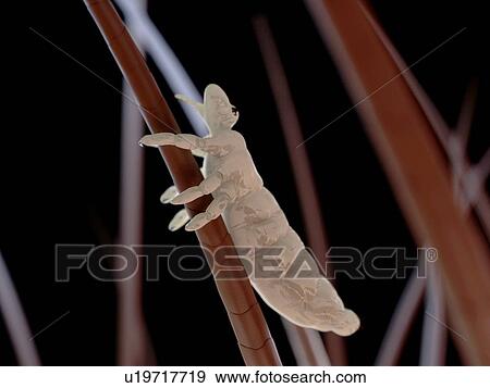 Stock Photo - Head louse (Pediculus humanus capitis), computer artwork.. Fotosearch