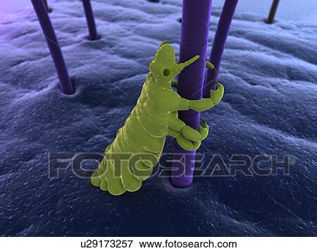 Stock Photo - Head louse (Pediculus humanus capitis), computer artwork.. Fotosearch