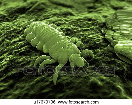Head louse (Pediculus humanus capitis), computer artwork. View Large Photo Image Stock Photograph - Head louse (Pediculus humanus capitis), computer artwork.. Fotosearch
