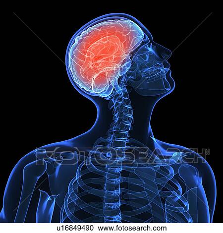 Stock Image - Headache, conceptual computer artwork.. Fotosearch
