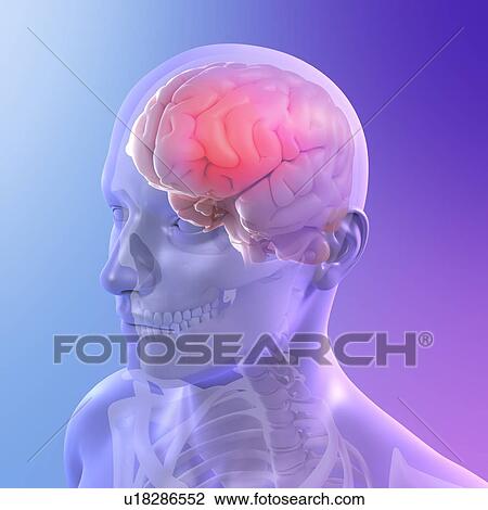 Stock Image - Headache, conceptual computer artwork.. Fotosearch