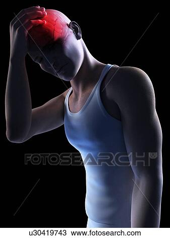 Headache, conceptual computer artwork. View Large Photo Image Stock Image - Headache, conceptual computer artwork.. Fotosearch