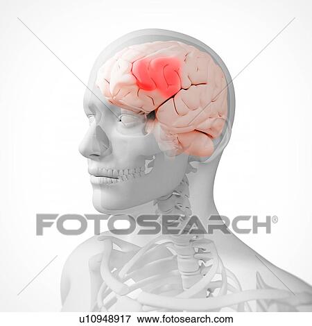 Headache, conceptual computer artwork. View Large Photo Image Stock Photo - Headache, conceptual computer artwork.. Fotosearch