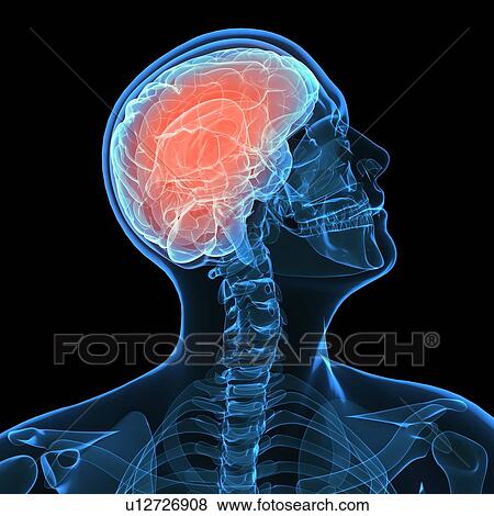 Headache, conceptual computer artwork. View Large Photo Image Stock Photo - Headache, conceptual computer artwork.. Fotosearch