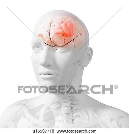 Headache, conceptual computer artwork. View Large Photo Image Stock Photo - Headache, conceptual computer artwork.. Fotosearch