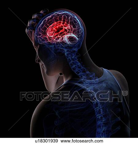 Headache, conceptual computer artwork. View Large Photo Image Stock Photo - Headache, conceptual computer artwork.. Fotosearch