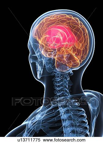 Headache, conceptual computer artwork. View Large Photo Image Stock Photography - Headache, conceptual computer artwork.. Fotosearch