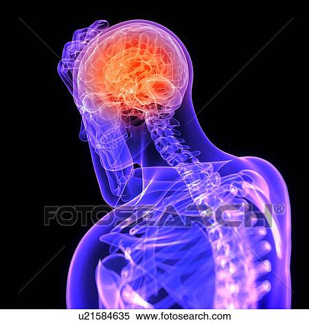 Headache, conceptual computer artwork. View Large Photo Image Stock Photography - Headache, conceptual computer artwork.. Fotosearch