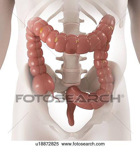 Healthy large intestine, computer artwork. View Large Photo Image Stock Photography - Healthy large intestine, computer artwork.. Fotosearch