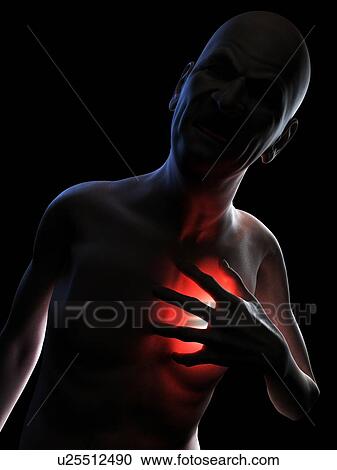 Stock Image - Heart attack, conceptual computer artwork.. Fotosearch
