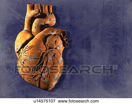 Stock Photo - Heart disease, conceptual computer artwork.. Fotosearch
