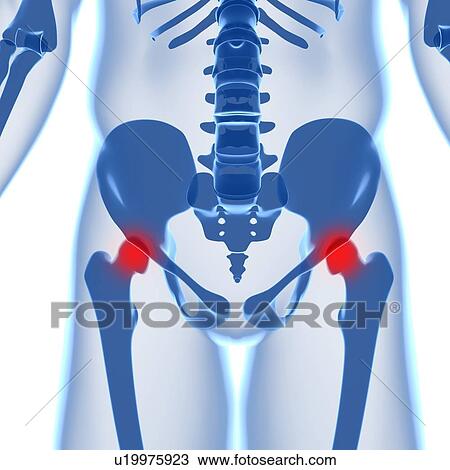 Hip pain, conceptual computer artwork. View Large Photo Image Stock Image - Hip pain, conceptual computer artwork.. Fotosearch