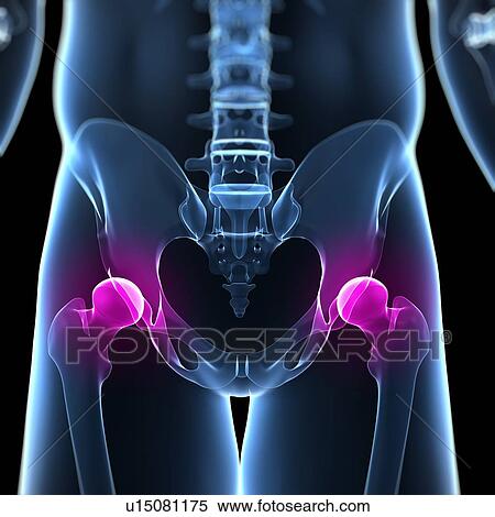 Hip pain, conceptual computer artwork. View Large Photo Image Stock Photography - Hip pain, conceptual computer artwork.. Fotosearch