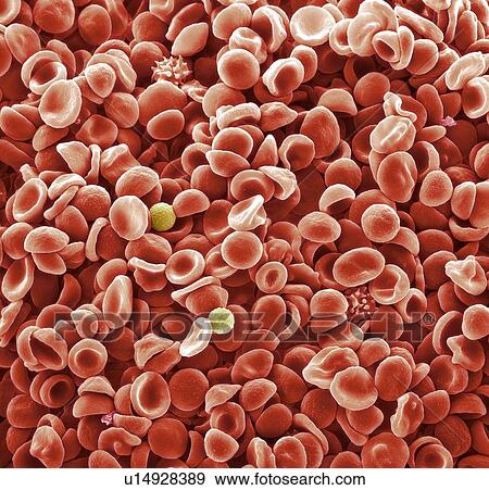 Human blood cells. Coloured scanning electron micrograph (SEM) of normal human blood. The majority of the cells are red blood cells, but white blood cells (yellow) and platelets (pink) are also seen. Magnification: x1350 when printed at 10 centimetres wid View Large Photo Image Stock Photo - Human blood cells. Coloured scanning electron micrograph (SEM) of normal human blood. The majority of the cells are red blood cells, but white blood cells (yellow) and platelets (pink) are also seen. Magnification: x1350 when printed at 10 centimetres wid. Fotosearch