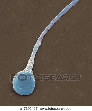 Stock Photo - Human sperm cell, coloured scanning electron micrograph (SEM). Magnification: x8000 when printed at 10 centimetres tall.. Fotosearch
