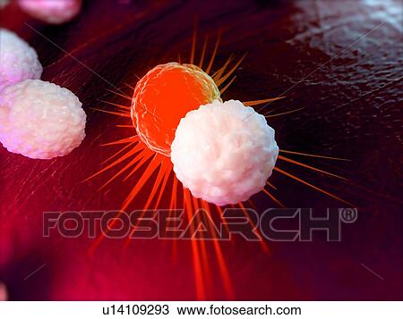 Stock Image - Immune response to cancer. Computer artwork of white blood cells attacking a cancerous cell.. Fotosearch