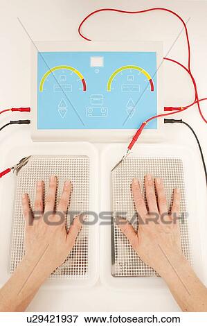 Iontophoresis. This is a treatment for excess sweating of the hands. View Large Photo Image Stock Photo - Iontophoresis. This is a treatment for excess sweating of the hands.. Fotosearch