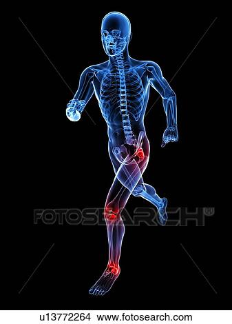 Joint pain, conceptual computer artwork. View Large Photo Image Picture - Joint pain, conceptual computer artwork.. Fotosearch