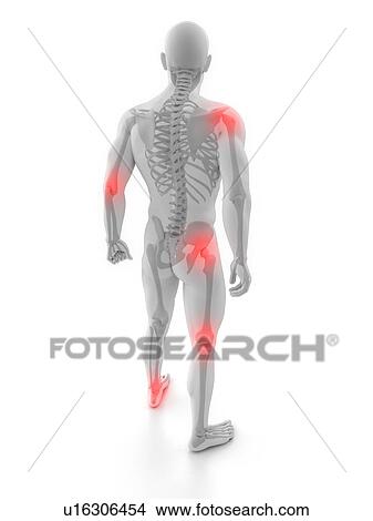 Picture - Joint pain, conceptual computer artwork.. Fotosearch