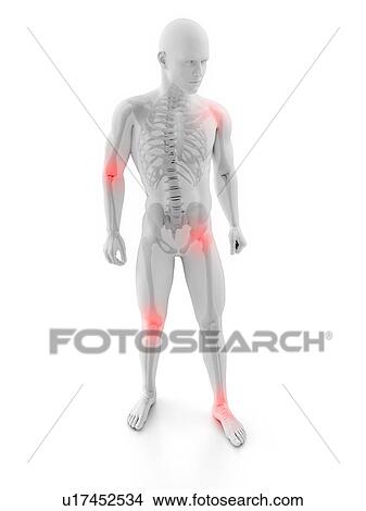 Joint pain, conceptual computer artwork. View Large Photo Image Picture - Joint pain, conceptual computer artwork.. Fotosearch