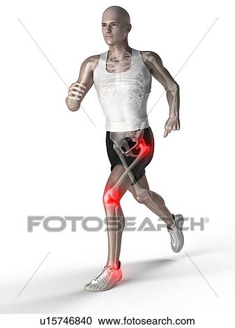 Joint pain, conceptual computer artwork. View Large Photo Image Stock Image - Joint pain, conceptual computer artwork.. Fotosearch