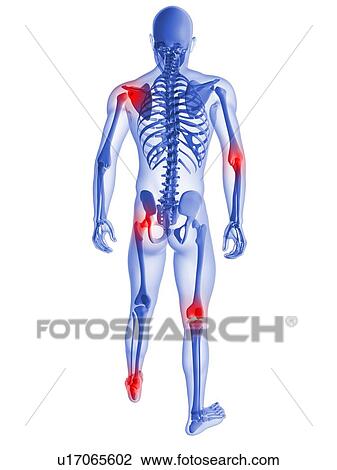 Stock Image - Joint pain, conceptual computer artwork.. Fotosearch